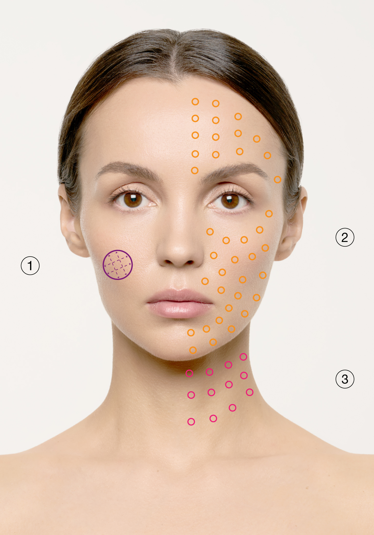 Post-Acne